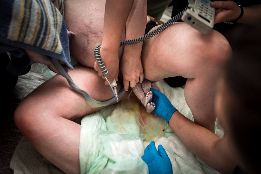 Baby B presenting footling breech during a birth story in salt lake city utah