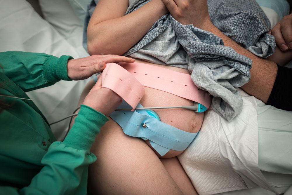 A nurse puts on fetal monitors around mothers belly during a hospital birth story
